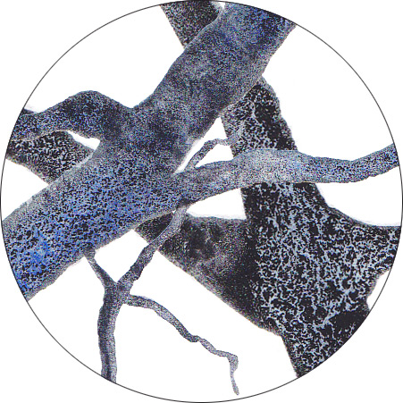 Detail aquarelle Arbres d-Hiver CatMat 2024